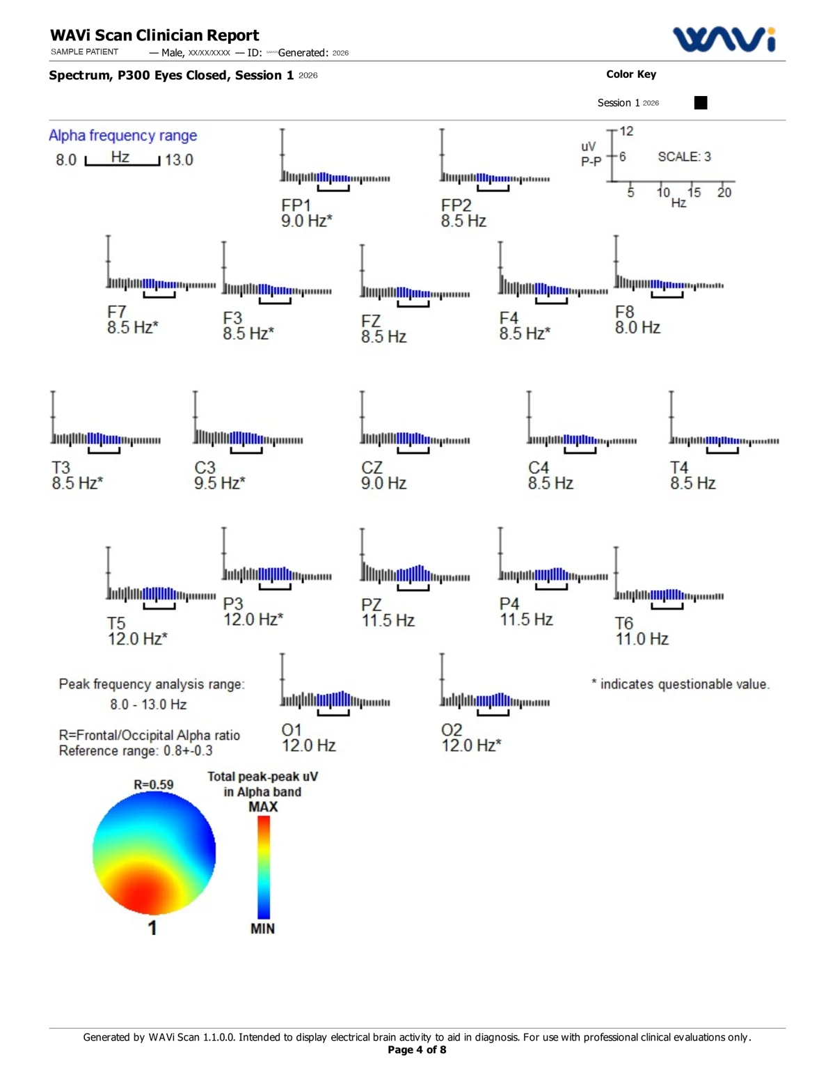 WAVi Scan clinician report, page 4 of 8, de-identified